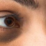 काले घेरों ने छीन ली है आंखों की खूबसूरती, तो आज़माएं ये टिप्स