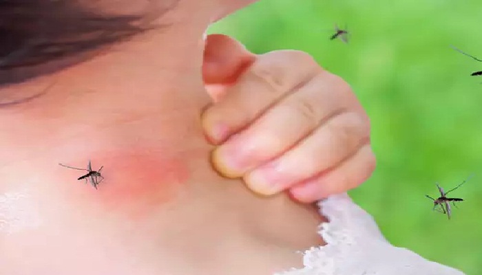 मच्छरों की भिनभिनाहट से है परेशान, छुटकारा दिलाएगी ये चीजें