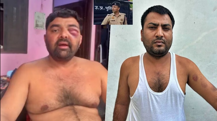 SSP ऑफिस में पिटाई का आरोप! सपा नेता बोले- लात-घूंसों और लाठियों से पीटा, पुलिस ने दी सफाई