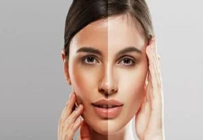 सनटैन की समस्या से मिलेगा छुटकारा, बस कर लें ये उपाय