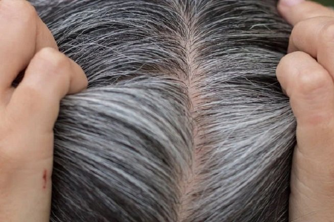 इस डाई से सफेद बाल होंगे काले, जानें तरीका
